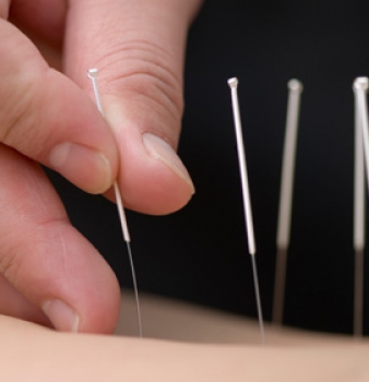STUDY: Acupuncture Treats Depression as well as Therapy